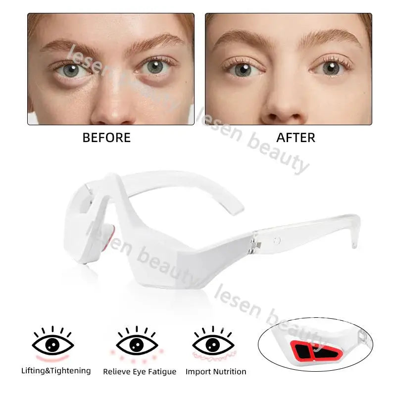 3D EMS Micro Current Mini Eye Beauty Device Red Light Massager Eye Anti Aging Eye Care Instrument Therapy Patches Device Under